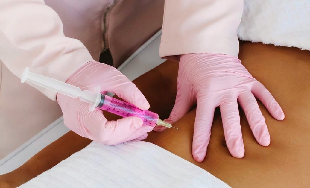 ¿Qué es la Mesoterapia y para qué sirve?
