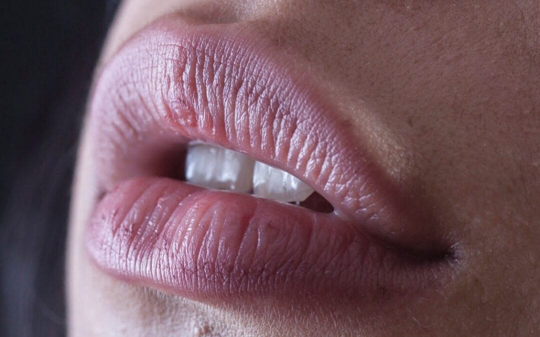 Tratamientos para labios: ácido hialurónico, perfilado y relleno de labios