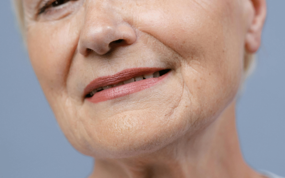 Arrugas código de barras: qué son y cómo eliminarlas