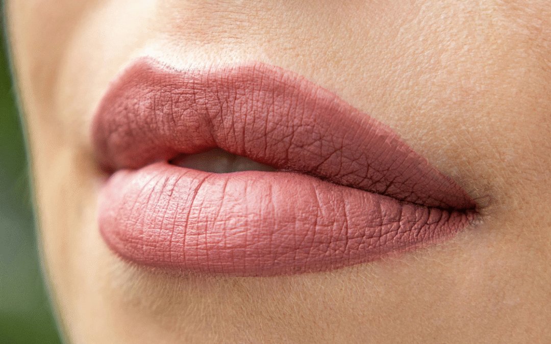 Aumento de Labios muy finos con Ácido Hialurónico