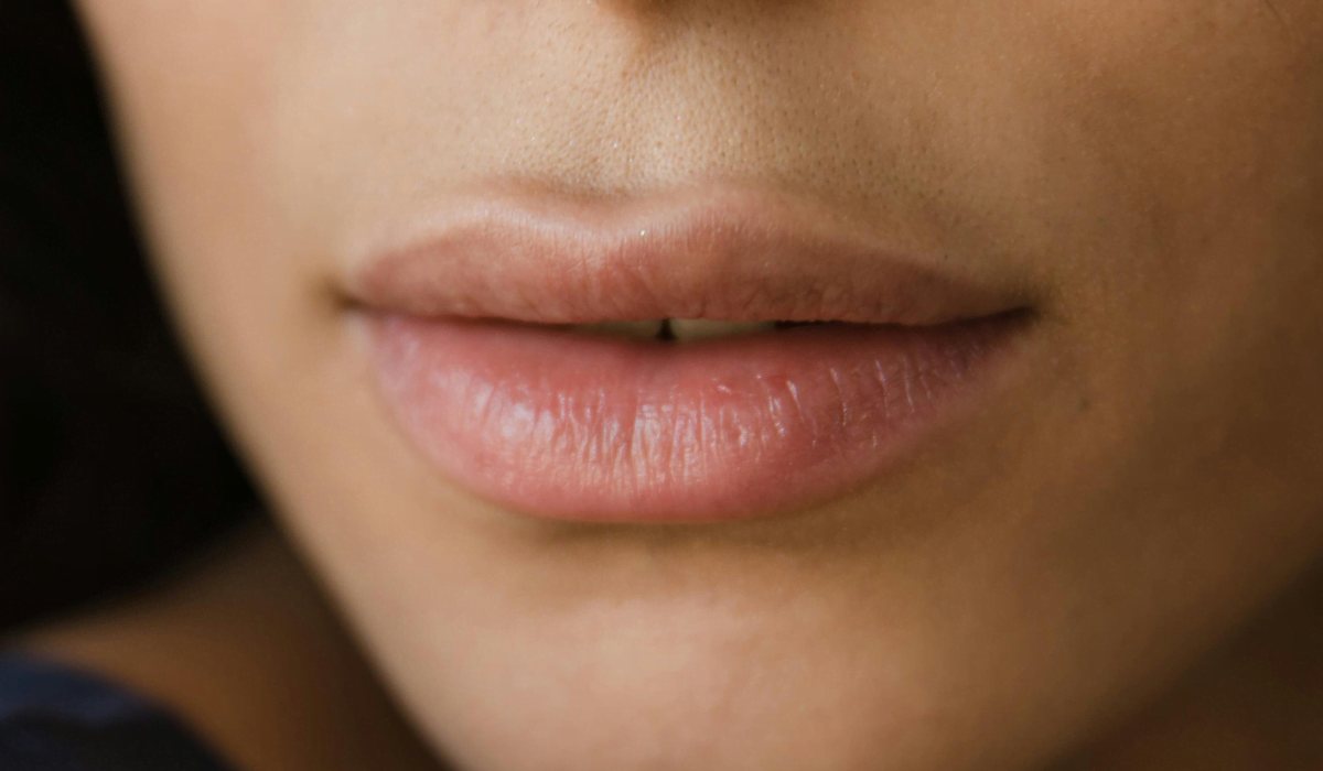 Perfilado de labios, antes y después